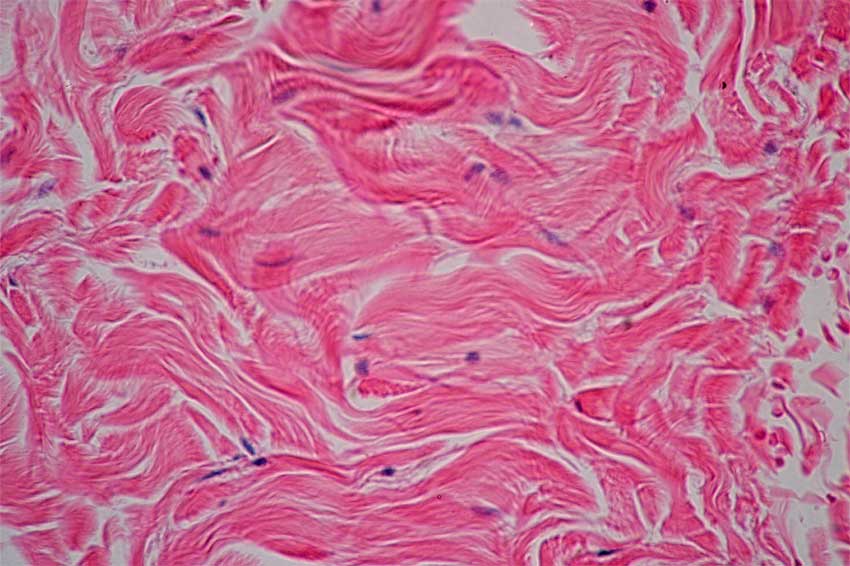 Dense Irregular Connective Tisse